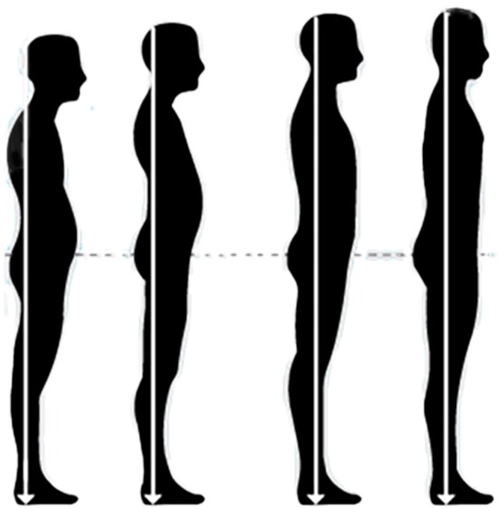 Zentherapie – Illustration der Körperstatik