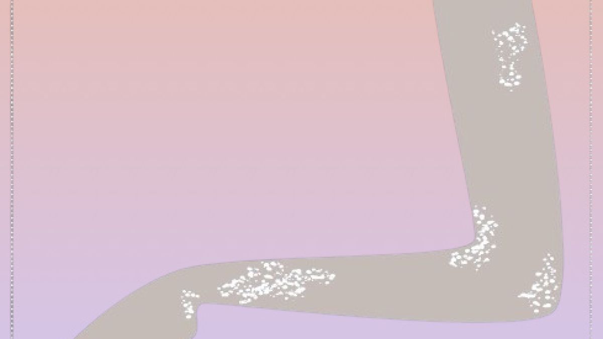 Schuppenflechte (Psoriasis)
